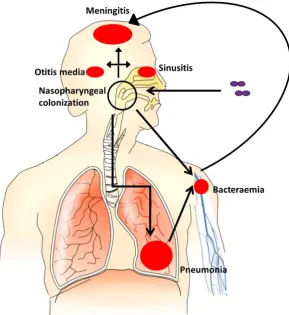 Figure 1.3: Pathogenesis of pneumococcal disease. 