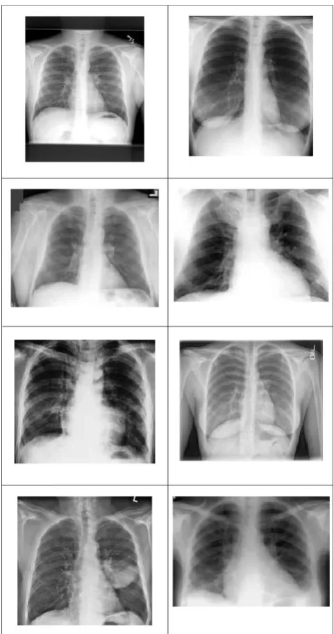 Fig. 1: The compression/decompression front end for the X-Ray image 