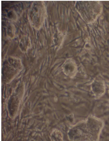 Fig. 1.: ES cell colonies growing on fibroblast layer 