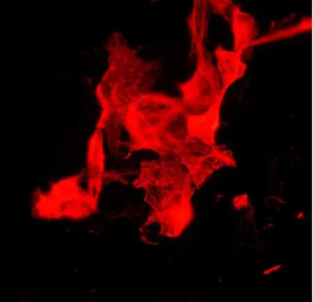 Fig. 7.: Cytokeratin expression in attached EB on gelatin coated surface. 