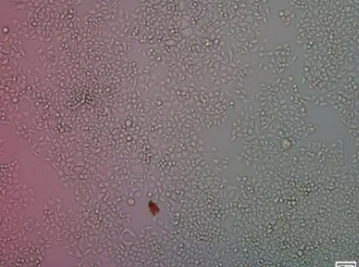 Figure 1.  HeLa  cells  cultured with 24 well  plastic  culture plate. HeLa cells grew as spindle – shaped  mono-layer cell that attached to the plate bottom.