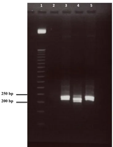 Figure 6.1: Agarose gel (2.5%) profile of 16s rRNA gene GC-Clamp PCR product 