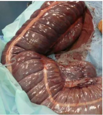 Figure 1:  Intra-operative photographic 