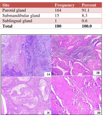 Table 3: Site distribution of major salivary gland  tumours. 