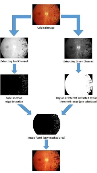 Fig 1: Overview of experimental steps towards the study for automated detection of features in a defective eye