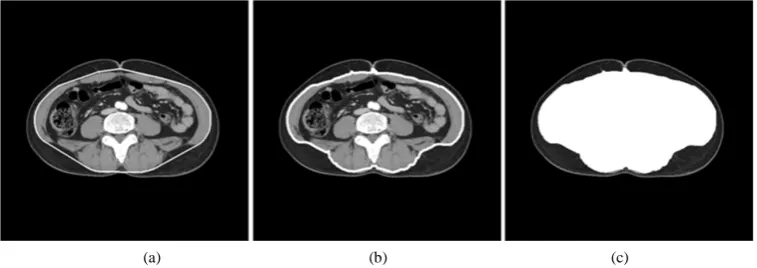 Figure 2. Process of automatic adipose tissue detection. (a) Result of convex hull; (b) Result of adjusted closed path; (c) Result of separation mask