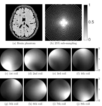 Fig. 1. Figure 1(a) shows the brain phantom as described in Section 6.1. Figure 1(c)- 1(j) show visualisations of the measured coil sensitivities of a water bottle