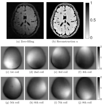 Fig. 2. Reconstructions for noise with low noise level σ = 0.05. Despite the sub-sampling, features of the brain phantom are very well preserved