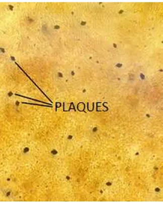 Figure 2.1. Microscopic image of RSV plaques formed during the 