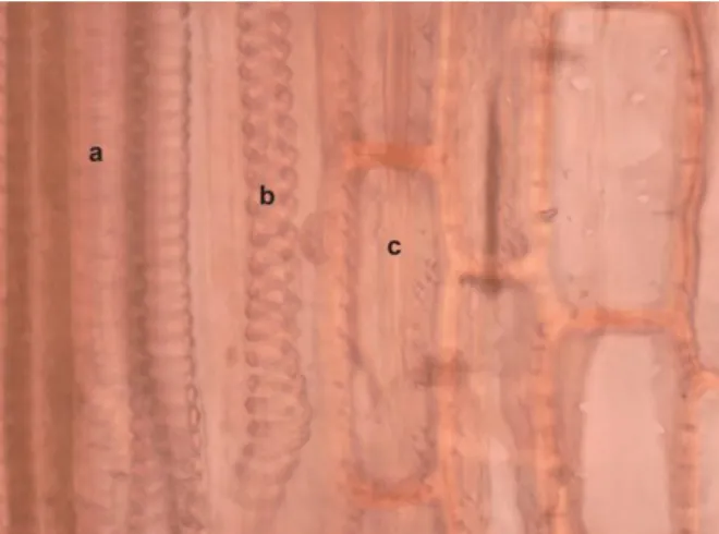 Figure 6. Longitudinal-radial section through C. persicifolia aboveground stem:   (a) reticulate xylem vessel; (b) helical xylem vessel; (c) xylem parenchyma  