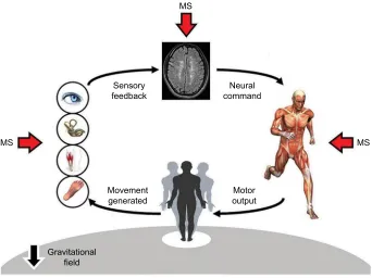 Figure 1 Schematic of postural control and its alterations in MS.Abbreviation: MS, multiple sclerosis.