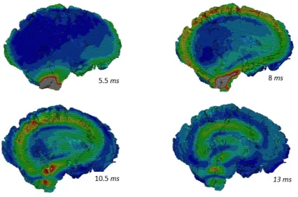 Table 3. Difference of material properties and peak pressure response for three distinct points (indicatedin Figure 7) along the sagittal plane within the white matter.