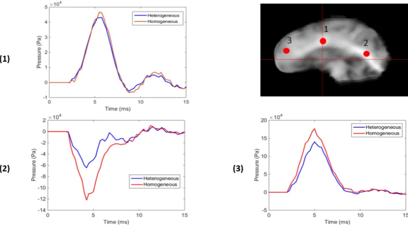 Figure 7.Comparison of pressure at three points on the sagittal plane.The difference in theheterogeneous and homogeneous models is most evident in regions of high relative stiffness.