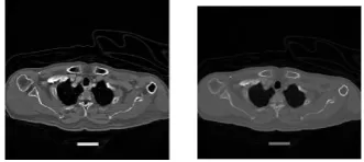 Fig 4. Pre-processed images of patients selected randomly 