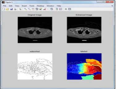 Fig 8.Output for pre-processed image  