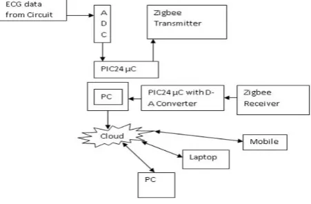 Fig. 1 ECG Diagram (From Wikipedia)   