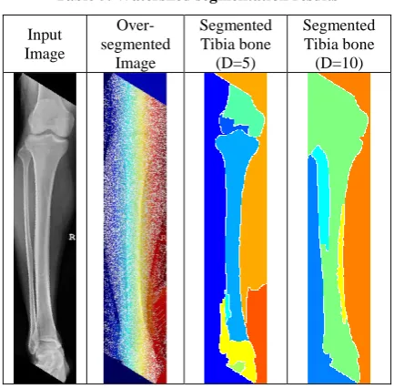 Table 4. Otsu segmentation results 