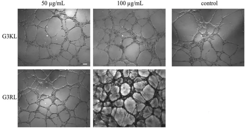 Figure 4. Images of the endothelial tubular networks in Matrigel after 5 hours treatment with G3KL and G3RL at indicated concentrations versus PBS control