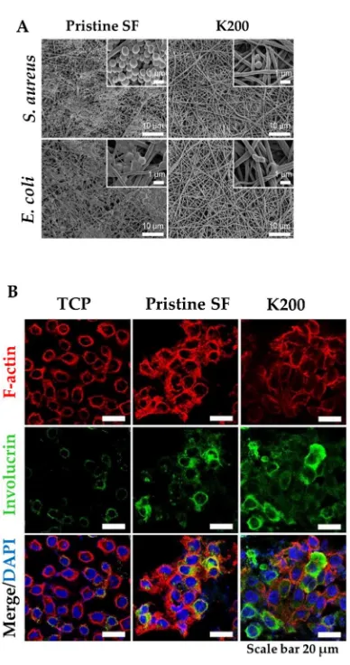 Figure 6. (A) FE-SEM images of (K200). (B) Confocal immunofluorescence images of keratinocytes cultured on TCP (tissue culture treated), pristine SF and K200 (red channel, F-actin; green, involucrin; blue, DAPI)