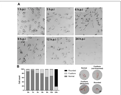 Fig. 1 Characterization of cytopathic effect of Orpheovirus.of normal cells, while fusiform cells increased at 9 h.p.i., composing ~ 40% of the total infected cells