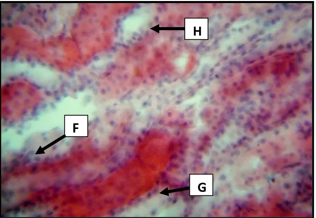 Figure 3: Photomicrograph of a group 3 (500mg/kg ELSV) Rat’s Kidney. 