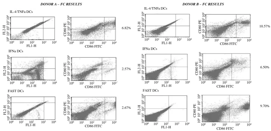 Figure 4. Flow cytometric results for CD80/CD86 markers. Donor A & B. They are represented three different duplicates of photos for each donor