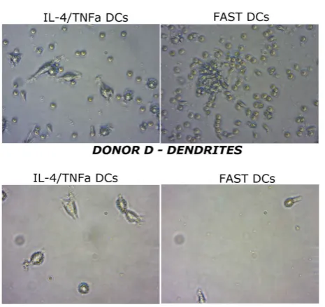 Figure 7. Donor E & F. The above duplicate of photos represents the DCs obtained from the IL-4/TNFa DC protocol for donor E and F respectively
