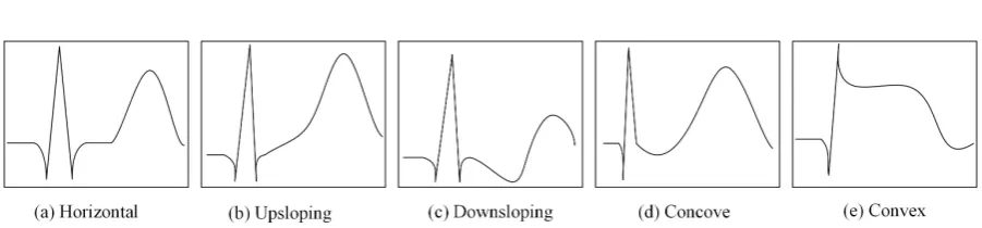 Figure 1. A reference ST set. 