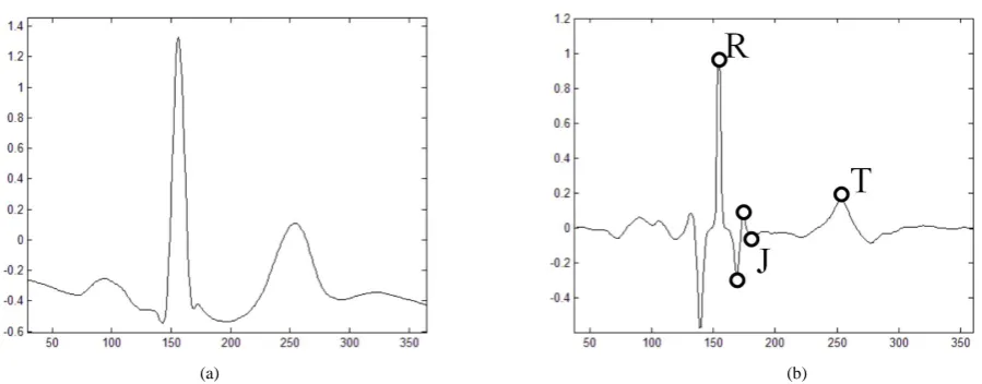 Figure 2. Original ECG signal (a) and the feature points of ST (b).  