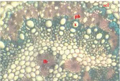 Fig. 6. Cross section of the blade with mid rib – detail (x 220): ph- phloem, lb- leptocentric bundle, scl- sclerenchyma, x – xylem.