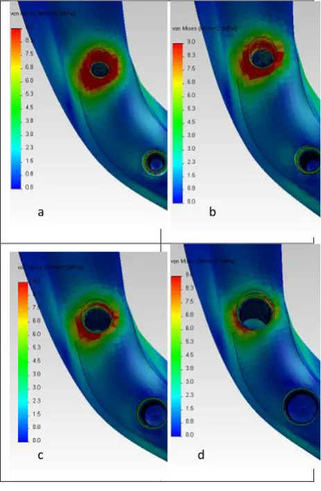 Fig 6: Crestal stress concentration with apical propagation  in the loaded side peri implant bone