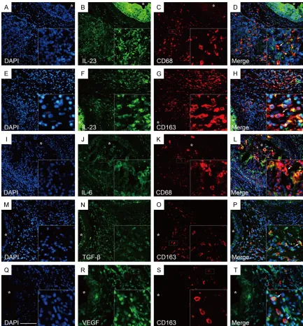 Figure 10. Immunofluorescence double staining of CD68+IL-23+, CD68+IL-6+, CD163+IL-23+, CD163+TGF-β+ and CD163+VEGF+ macrophages in the inflamed epididymis