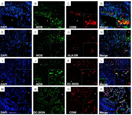 Figure 3. Immunofluorescence double staining of iNOS+CD68+, iNOS+HLA-DR+, iNOS+DC-SIGN+, CD68+DCSIGN+ M1 macrophages in the inflamed epididymis