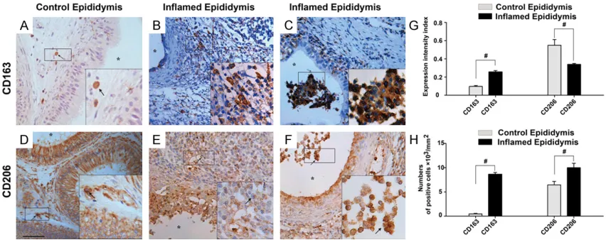 Figure 4. Distribution of CD163+, CD206+ cells in the inflamed epididymis and its controls