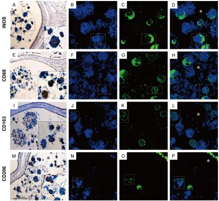 Figure 7. iNOS+CD68+ M1 and CD163+CD206+ M2 macrophages capturing spermatozoa in the lumen of cauda epididymidis
