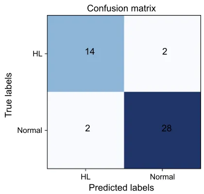 Figure 6 The confusion matrix of expanding learning.Abbreviation: HL, Hyperlipemia.