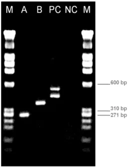 Figure 9: 2% agarose gel of the RT-nested-PCR G gene products with templates using UK3B (A), Merial Aviffa (B) 