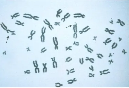 Figure 1.2: Metaphase Preparation of Human Lymphocytes for analysis of 