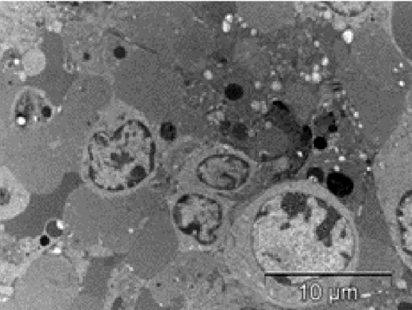 Fig. 1. Control variant. Lymphocytes in mitotic division (metaphase).