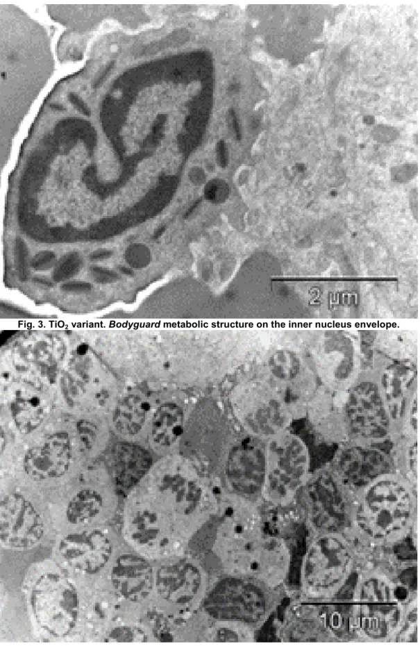Fig. 2. Control, X-rays variant. Adulteration induced by X-rays in lymphocyte. 