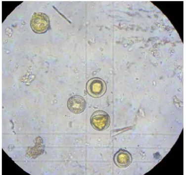 Figure 6.Counting the resistant spores in the Burker-Turk chambers