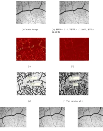 Figure 1: (a) Original image, (b) noisy one, (c) topological gradient for second-order, (d) topologicalgradient for fourth-order, (e) the variable q(·), (f) the variable p(·), (g) p(·)-Kirchhoﬀ model, (h) TVLmodel and (i) “Bi-Harmonic” model.