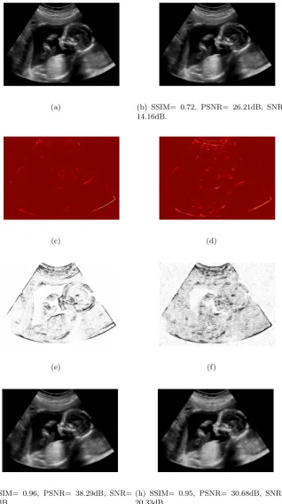 Figure 4: (a) Original image, (b) noisy one, (c) topological gradient for second-order, (d) topologicalgradient for fourth-order, , (e) the variable q(·), (f) the variable p(·), (g) p(·)-Kirchhoﬀ model, (h)TVL model.