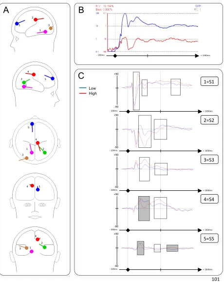 Figure 1. Scenario Consequence Components (A) Localisation of source dipoles shown schematically in the transparent glass brain
