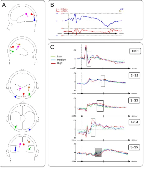 Figure 1. Perception Components (A) Localisation of source dipoles shown schematically in the transparent glass brain