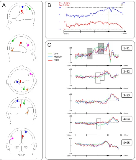 Figure 2. Movement Components (A) Localisation of source dipoles shown schematically in the transparent glass brain