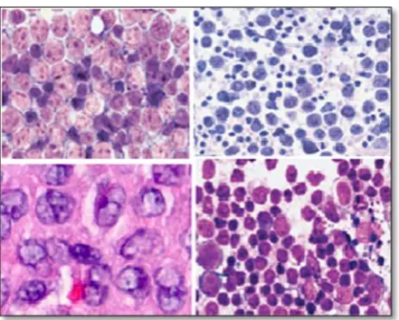 Fig 1: digital images with CB and non-CB cells. 
