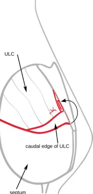 Figure 2. Schematic representation of the surgical technique infolding of the caudal part of the ULC