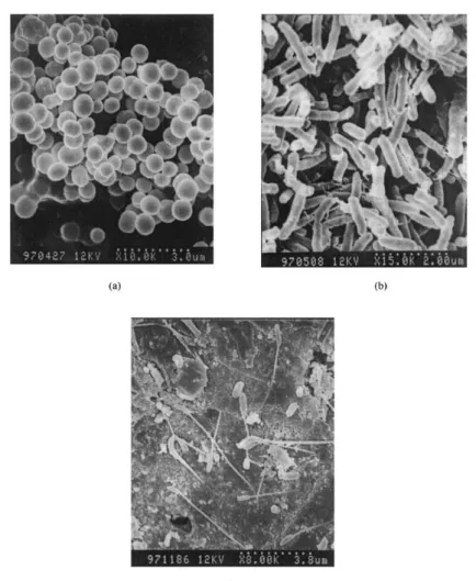 Figure 2 Images provided by electron microscope with different hydrocarbon degrading bacteria  (Li  et al., 2000) 