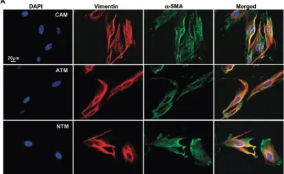 Figure 2. 3. Characterisation of myofibroblast cell types.  Immunofloruescnce to show strong coexpression of the myofibroblast markers vimentin and  α -SMA in isolated primary human CAMs, ATMs and NTMs